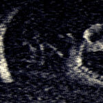 Iron Lung Store Page Image 2