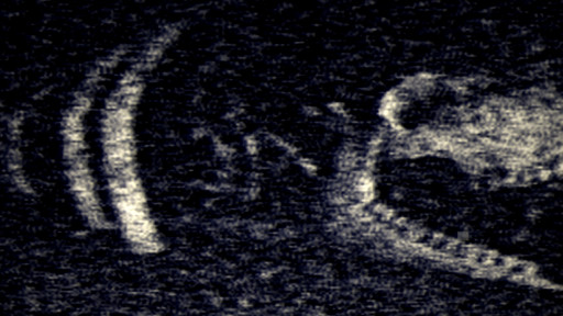 Iron Lung Store Page Image 2