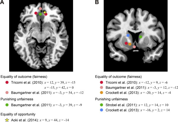 Illustration of a brain showcasing the areas activated during the Ultimatum Game